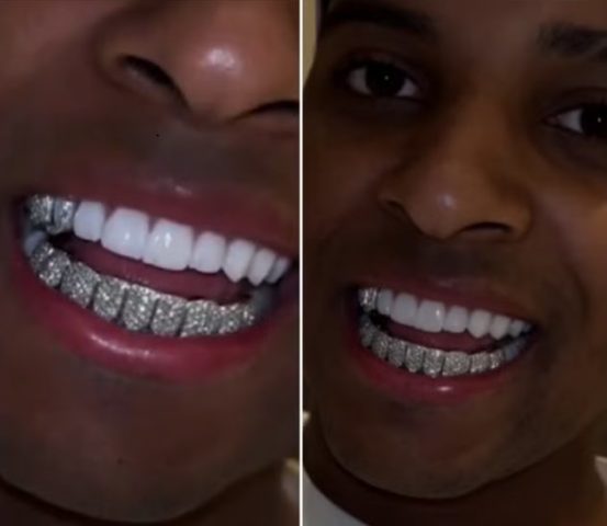 Dental grillz: atacante Rodrygo adere à moda e coloca pedras preciosas nos dentes