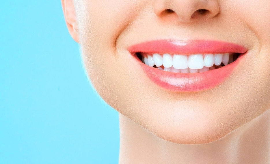 Clareamento dental: o sorriso perfeito está mais acessível